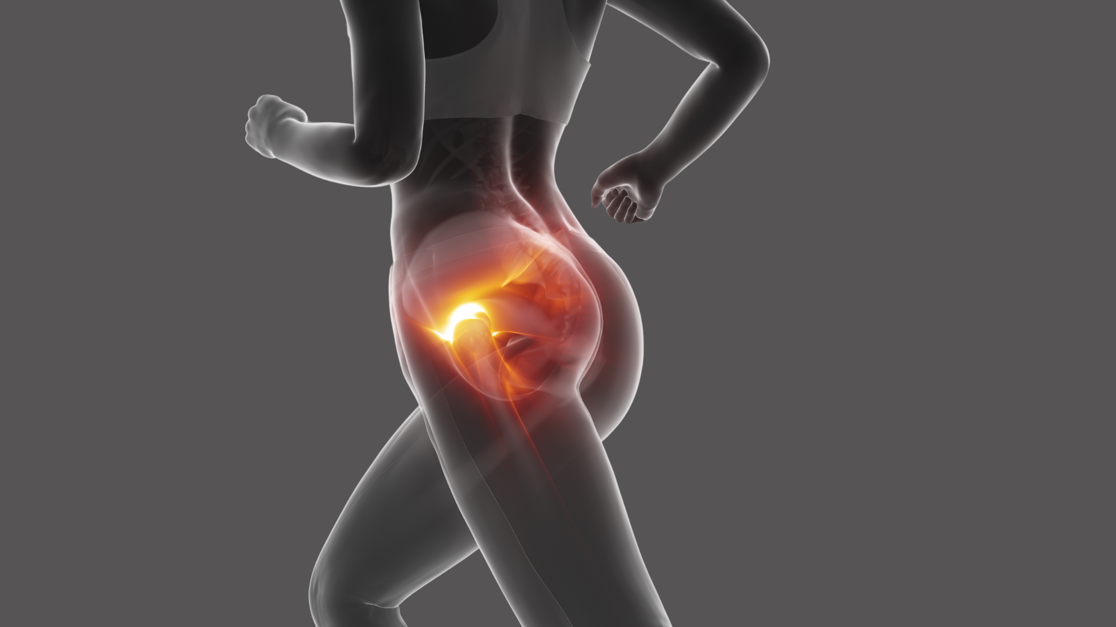 BBL Transforms Hip Dips and Boosts Confidence